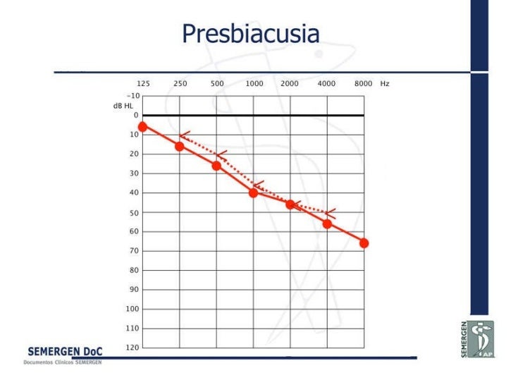audiometria presbiacusia